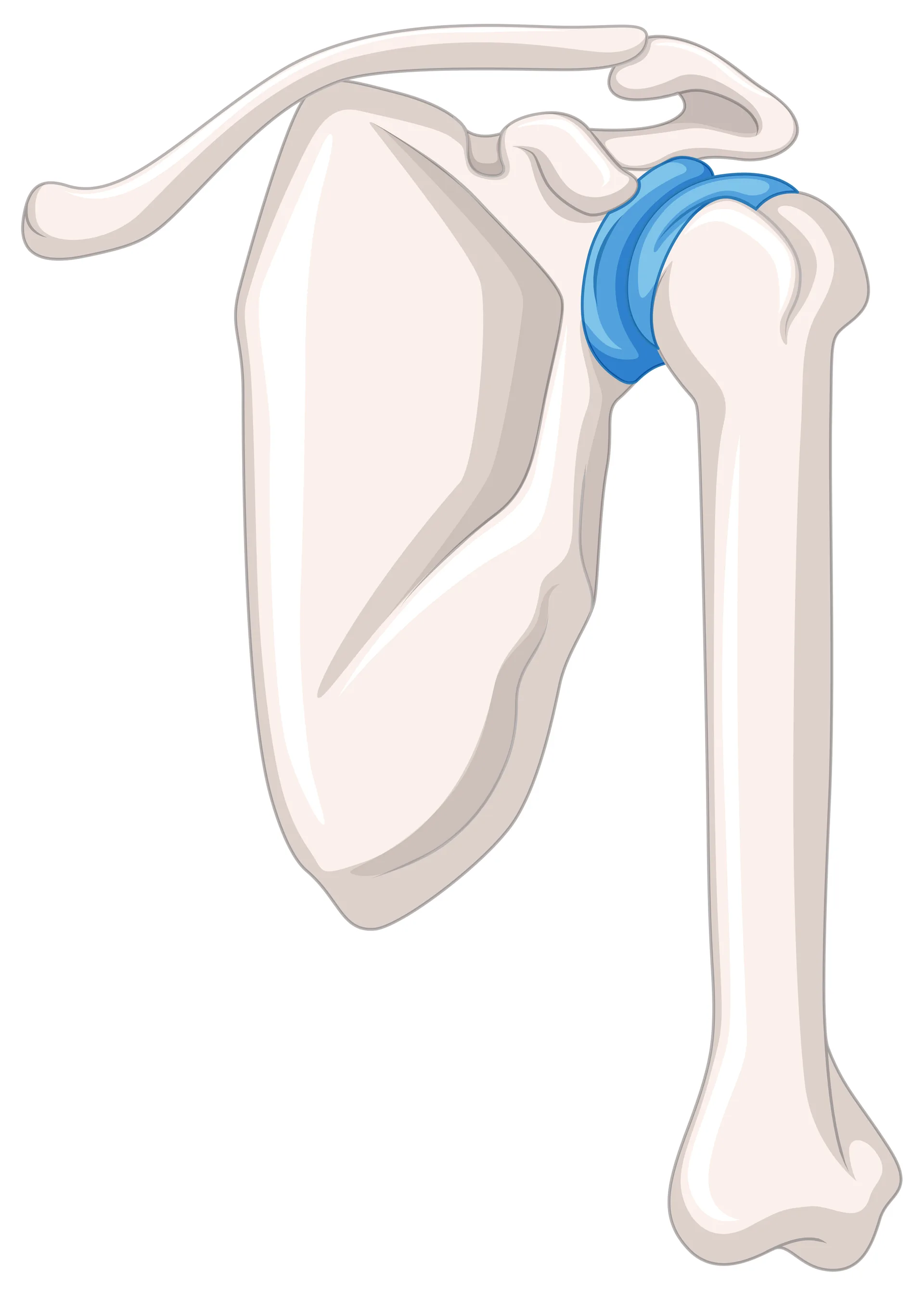 Shoulder Replacement anatomy illustration